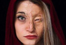 بررسی بزه اسیدپاشی علیه زنان ; بیش از نصف قربانیان اسیدپاشی را زنان تشکیل می دهند