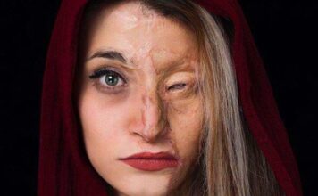 بررسی بزه اسیدپاشی علیه زنان ; بیش از نصف قربانیان اسیدپاشی را زنان تشکیل می دهند